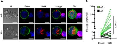 Is the tumor cell side of the immunological synapse a polarized secretory domain?